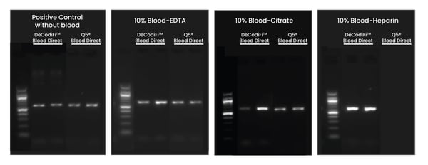 Comparison of direct PCR amplification (template size: 584bp) across various samples of human blood preserved with EDTA, citrate, and heparin using DeCodi-Fi™ Blood Direct and Q5 Blood Direct.