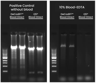 Comparison of direct PCR amplification of a human genomic amplicon of 17kb from 10% EDTA-preserved human whole blood using DeCodi-Fi™ Blood Direct and Q5 Blood Direct.